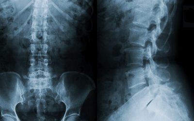 X-Rays and Treatment Plans